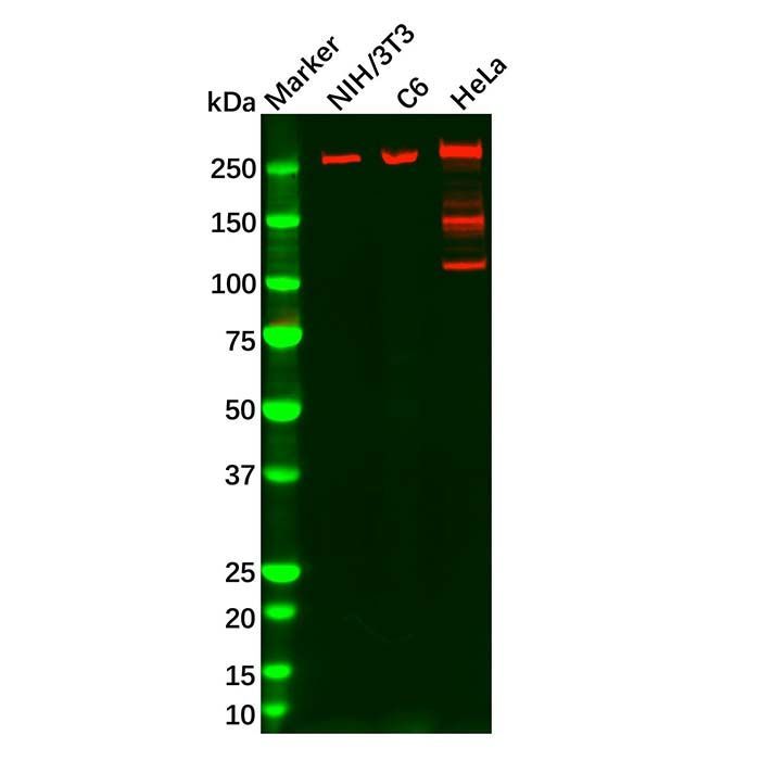 Fatty Acid Synthase Mouse mAb - by Aladdin Scientific