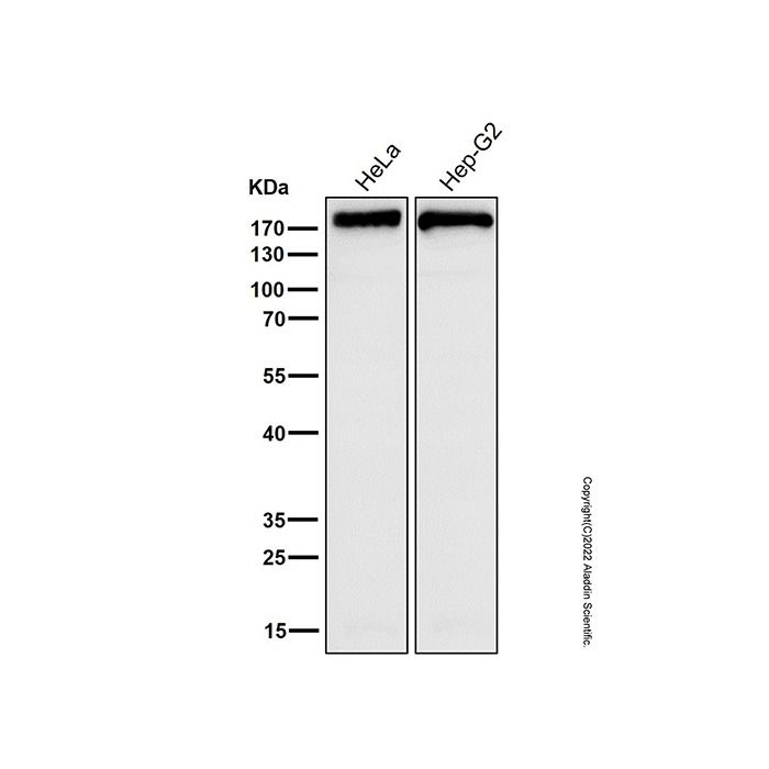 Recombinant Fatty Acid Synthase Antibody -    by Aladdin Scientific