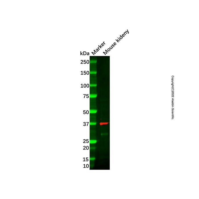 Recombinant FBP1 Antibody -    by Aladdin Scientific