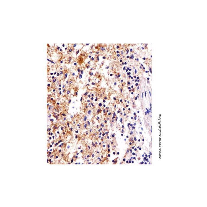 FcRgamma Antibody -    by Aladdin Scientific