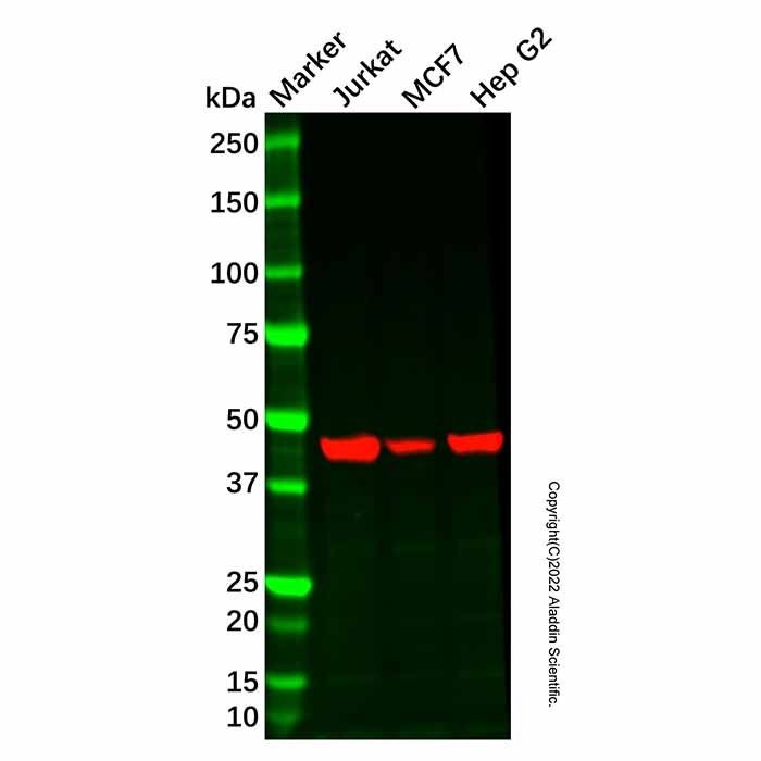 Recombinant FDFT1 Antibody -    by Aladdin Scientific