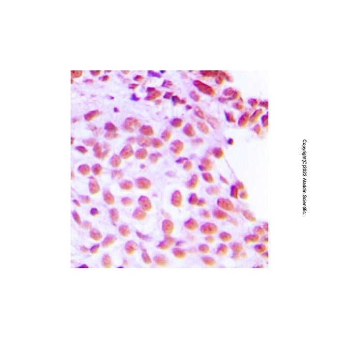 FEN1 Antibody -    by Aladdin Scientific