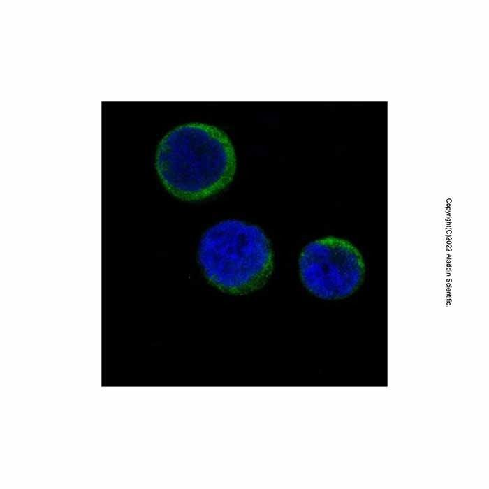 Recombinant Ferritin Antibody -    by Aladdin Scientific