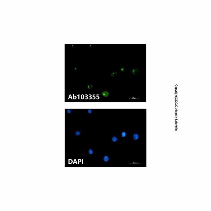 Recombinant FGFR1 Oncogene Partner Antibody -    by Aladdin Scientific
