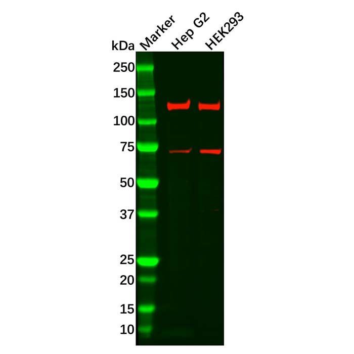 Recombinant FGFR3 Antibody -    by Aladdin Scientific