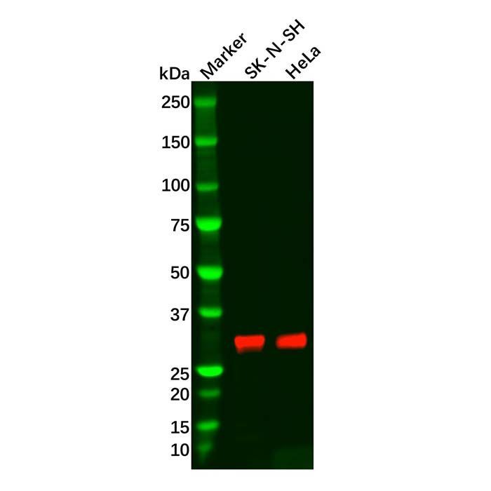 Recombinant FHL1 Antibody -    by Aladdin Scientific