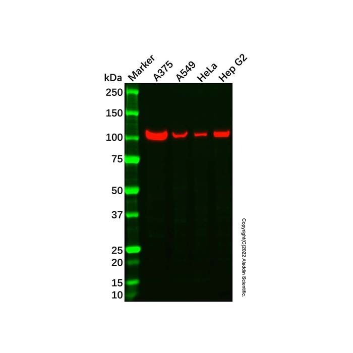 FIP Antibody -    by Aladdin Scientific