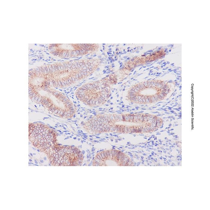 Recombinant Flotillin 1 Antibody -    by Aladdin Scientific