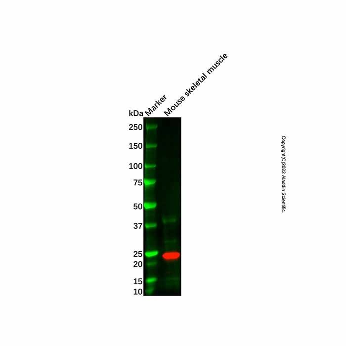 Recombinant FNDC5 Antibody -    by Aladdin Scientific