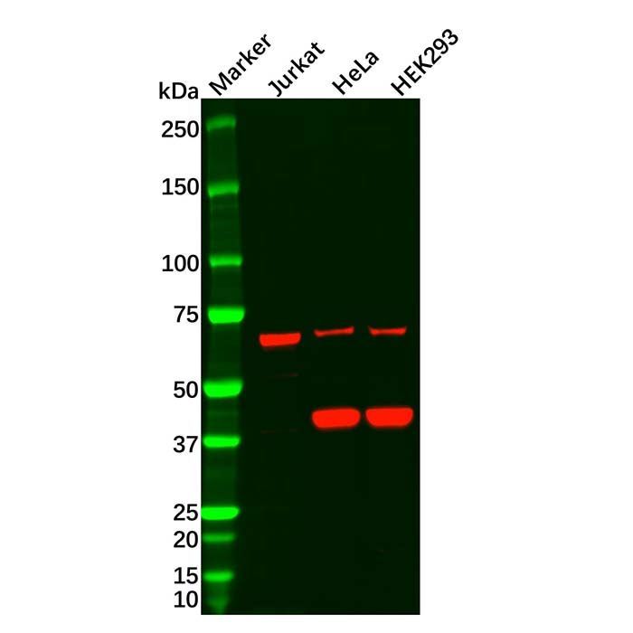 Recombinant Frizzled 8 Antibody -    by Aladdin Scientific