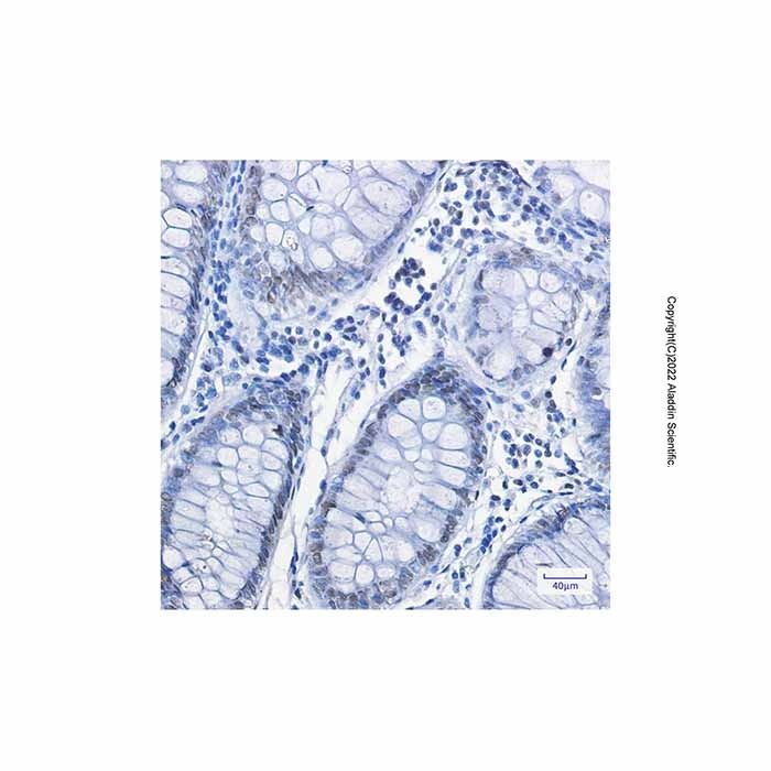 Recombinant FUBP1/FBP Antibody -    by Aladdin Scientific