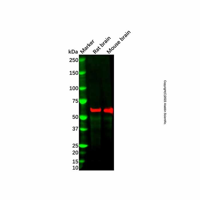GAD65 Mouse mAb -    by Aladdin Scientific
