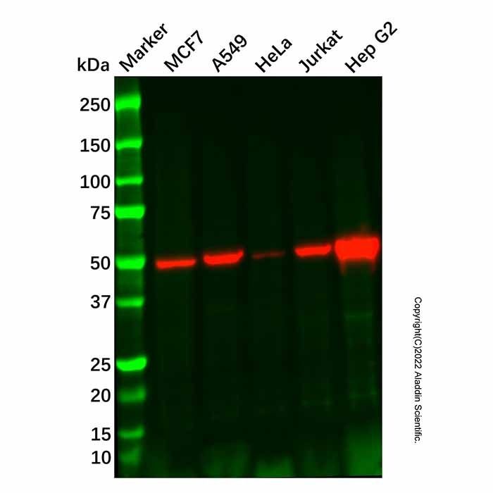 GALNT2 Antibody -    by Aladdin Scientific