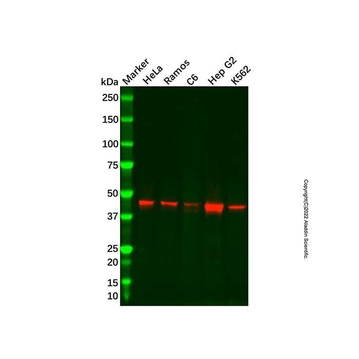 Recombinant GALT Antibody - by Aladdin Scientific
