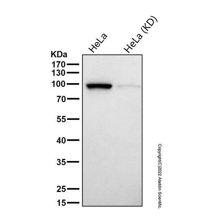Recombinant gamma Adaptin Antibody -    by Aladdin Scientific