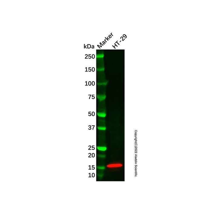 Recombinant gamma Synuclein/SNCG Antibody -    by Aladdin Scientific