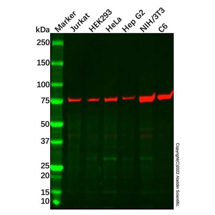 Recombinant GARS Antibody -    by Aladdin Scientific