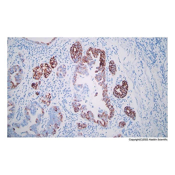 Recombinant Gastric Mucin/MUC-6 Antibody -    by Aladdin Scientific