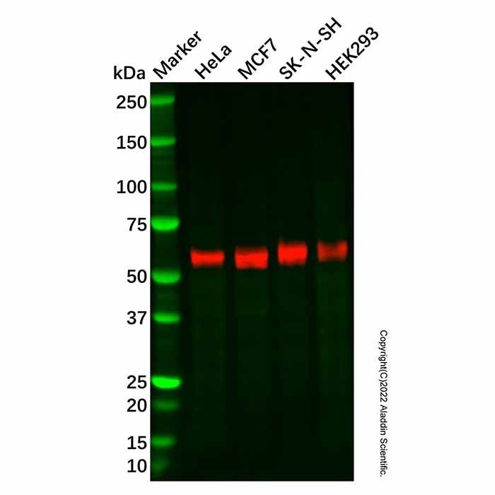 Recombinant GBA Antibody -    by Aladdin Scientific