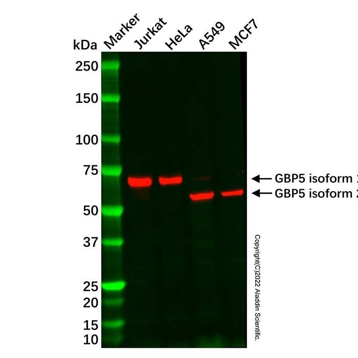 GBP5 Mouse mAb - by Aladdin Scientific