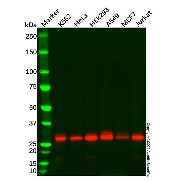GC1q R Mouse mAb -    by Aladdin Scientific