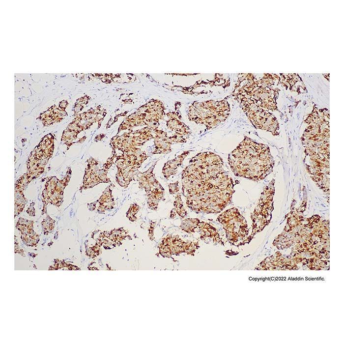Recombinant GCDFP 15 Antibody -    by Aladdin Scientific