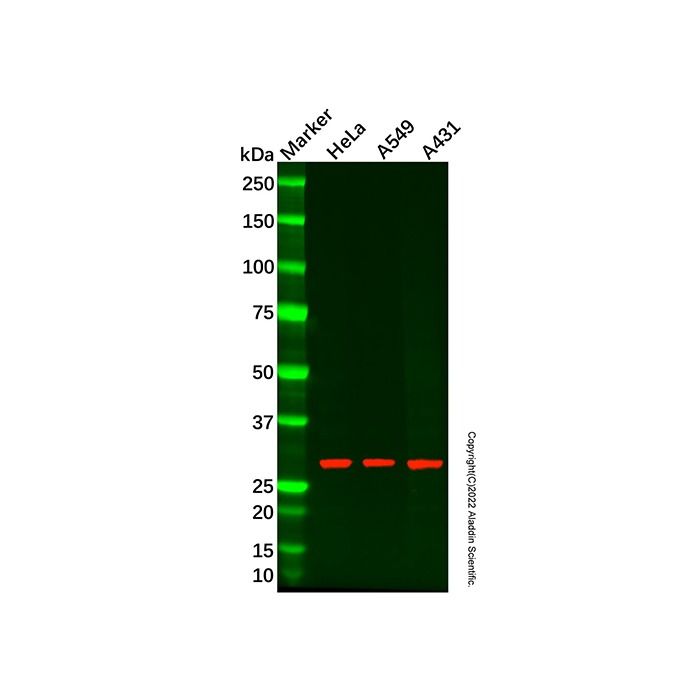 Recombinant GCLM Antibody -    by Aladdin Scientific