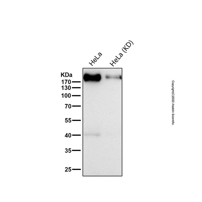 Recombinant GCN2 Antibody -    by Aladdin Scientific