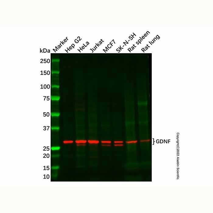 Recombinant GDNF Antibody -    by Aladdin Scientific