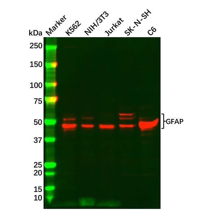 GFAP Antibody - by Aladdin Scientific