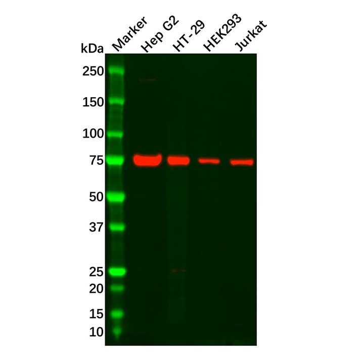 Recombinant GFPT1 Antibody -    by Aladdin Scientific