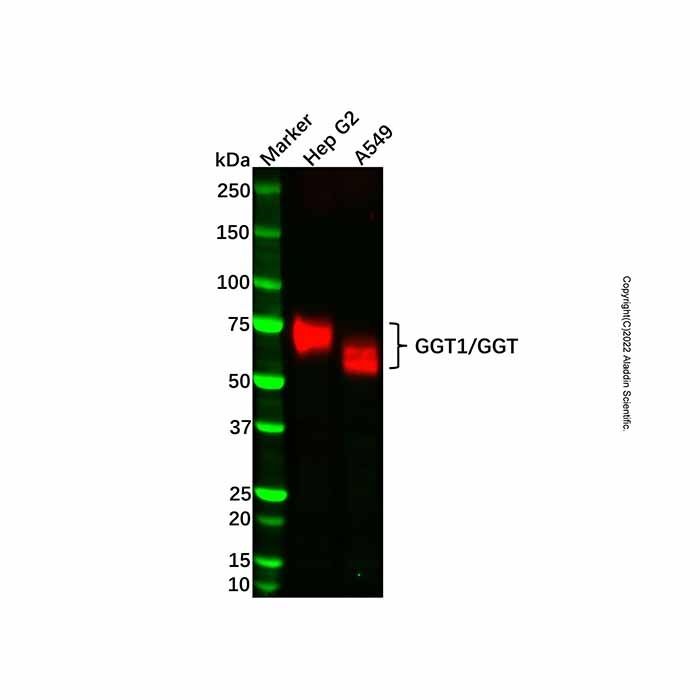Recombinant GGT1/GGT Antibody -    by Aladdin Scientific