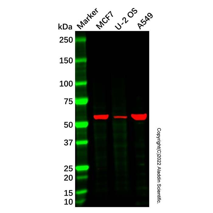 Recombinant Glucose 6 Phosphate Dehydrogenase Antibody -    by Aladdin Scientific
