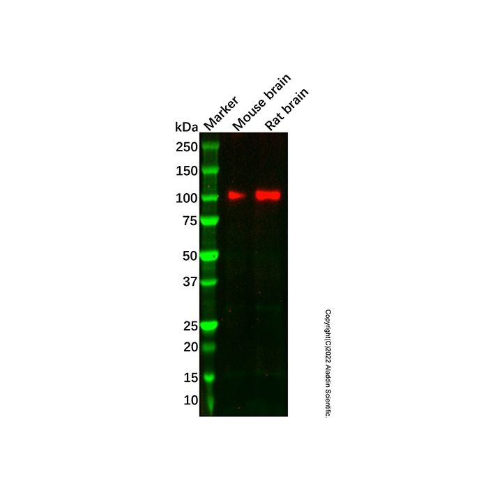 Recombinant Glutamate Receptor 1 Antibody -    by Aladdin Scientific