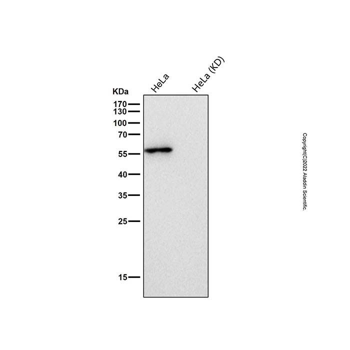 Recombinant Glutathione Reductase Antibody -    by Aladdin Scientific
