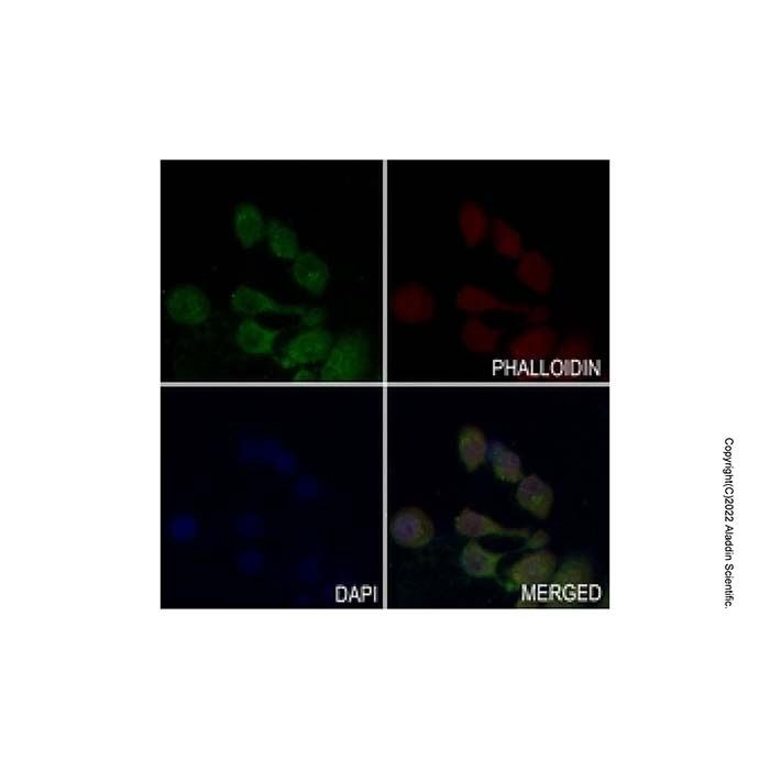 GPCR GPR120 Antibody -    by Aladdin Scientific