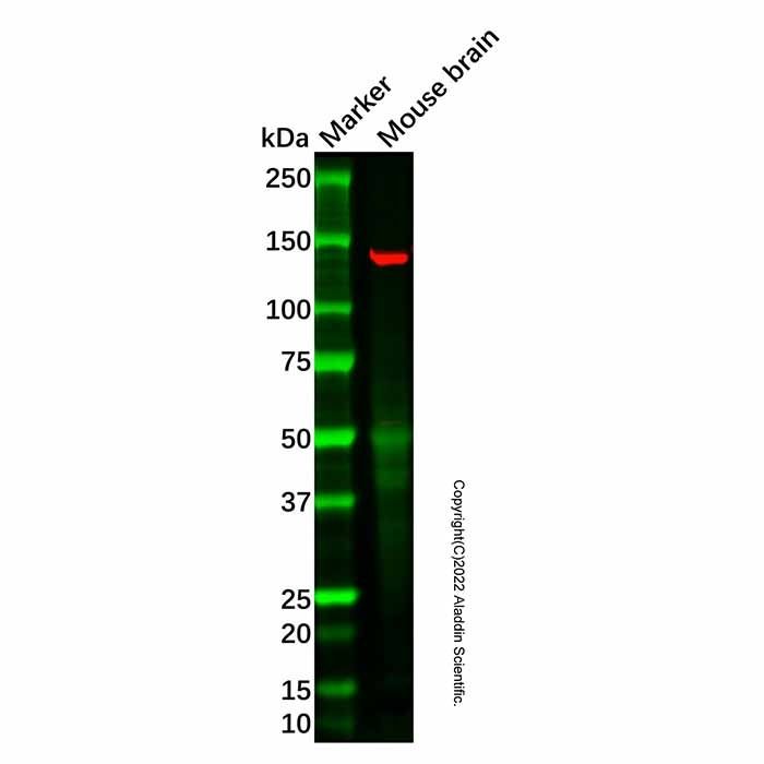 GPI-PLD Antibody -    by Aladdin Scientific