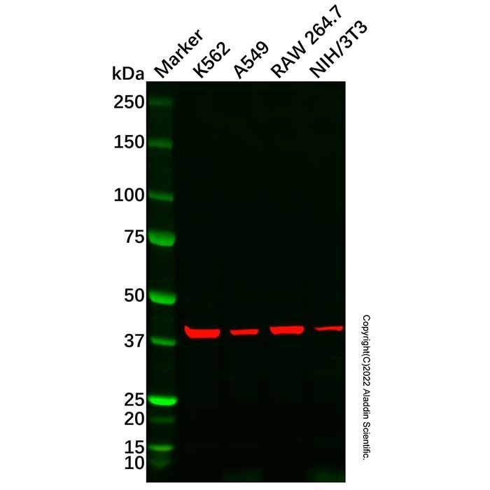 Recombinant GPR182 Antibody -    by Aladdin Scientific
