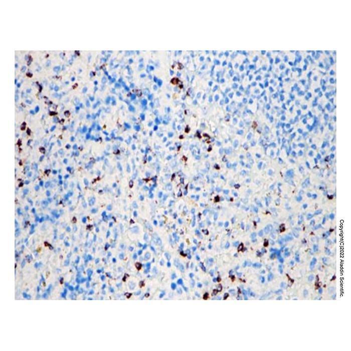 Recombinant Granzyme B Antibody -    by Aladdin Scientific