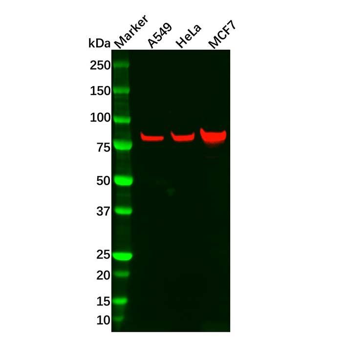 Recombinant GRK2 Antibody -    by Aladdin Scientific
