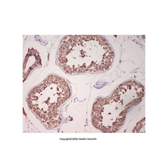 Recombinant GRP78 BiP Antibody -    by Aladdin Scientific