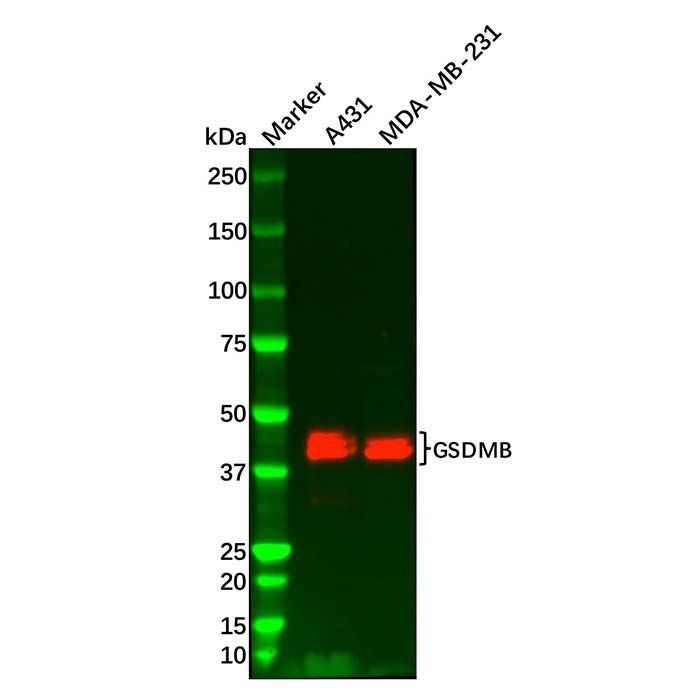 GSDMB Antibody -    by Aladdin Scientific
