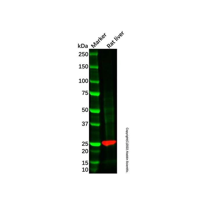 GSTT2B Mouse mAb -    by Aladdin Scientific