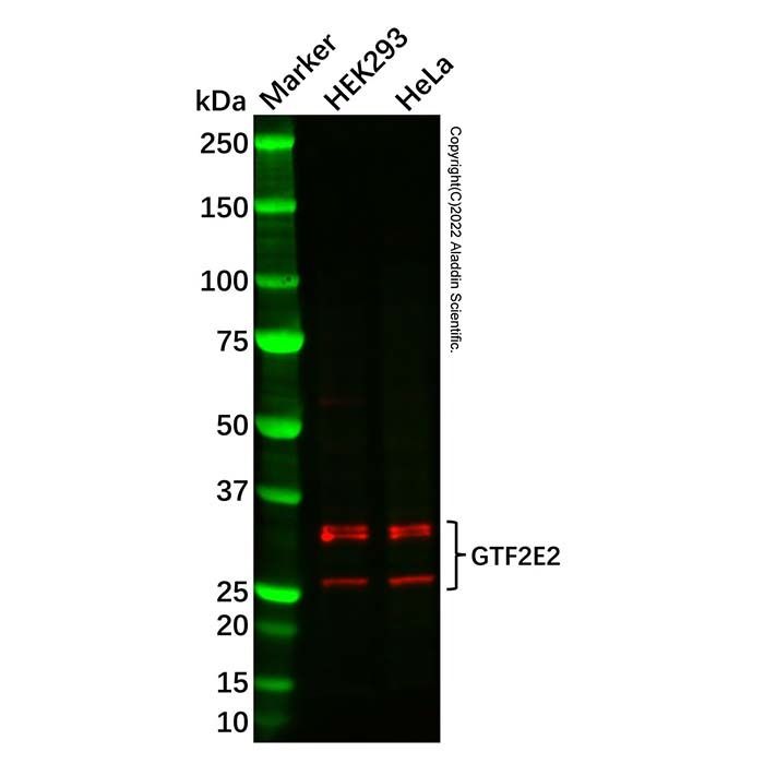 GTF2E2 Antibody -    by Aladdin Scientific