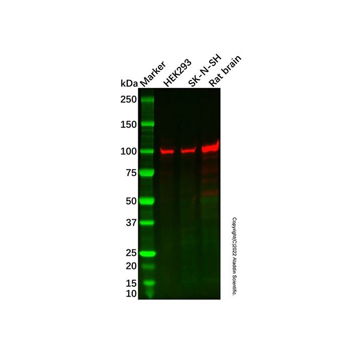 HACE1 Mouse mAb -    by Aladdin Scientific