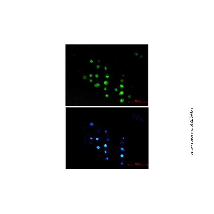 Recombinant HCE Antibody -    by Aladdin Scientific