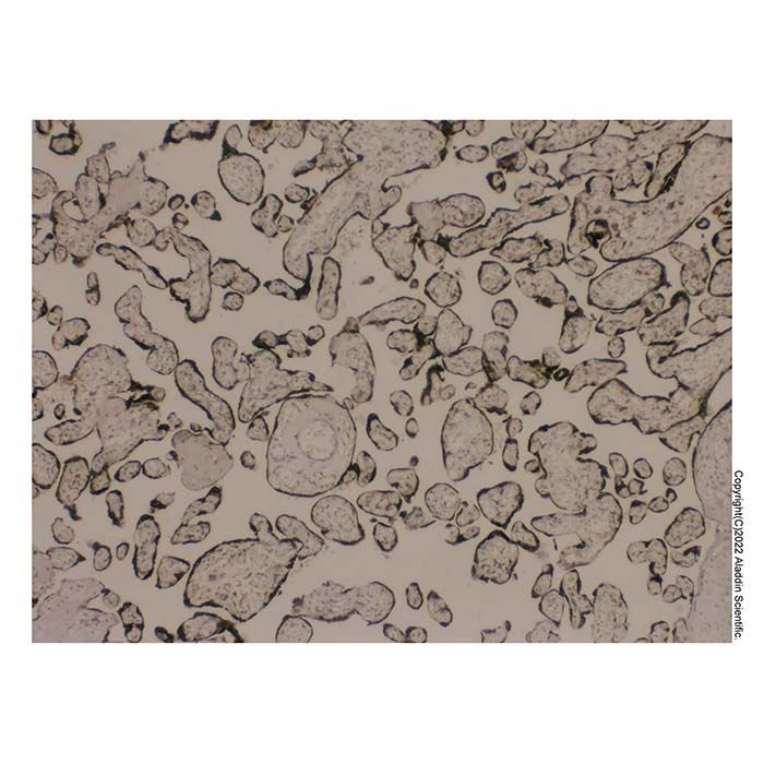 hCG Antibody -    by Aladdin Scientific