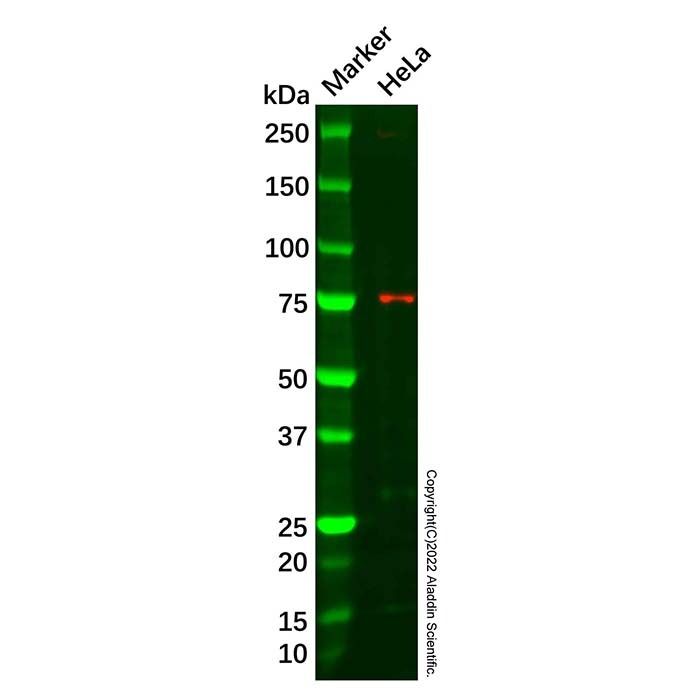 Recombinant HDAC10 Antibody -    by Aladdin Scientific