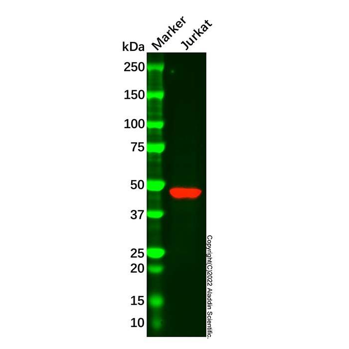 Recombinant HDAC11/HD11 Antibody -    by Aladdin Scientific