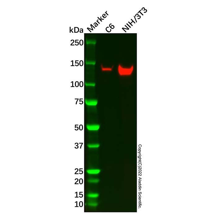 HDAC4 Mouse mAb -    by Aladdin Scientific